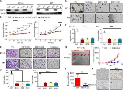 PHF20 Promotes Glioblastoma Cell Malignancies Through a WISP1/BGN-Dependent Pathway